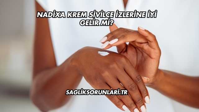 Nadixa Krem Sivilce İzlerine İyi Gelir mi?