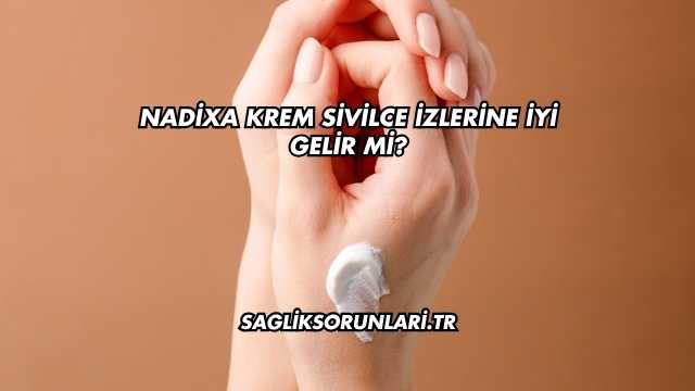 Nadixa Krem Sivilce İzlerine İyi Gelir mi?
