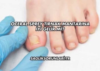 Oceral Sprey Tırnak Mantarına İyi Gelir mi?