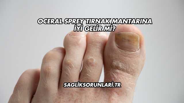 Oceral Sprey Tırnak Mantarına İyi Gelir mi?