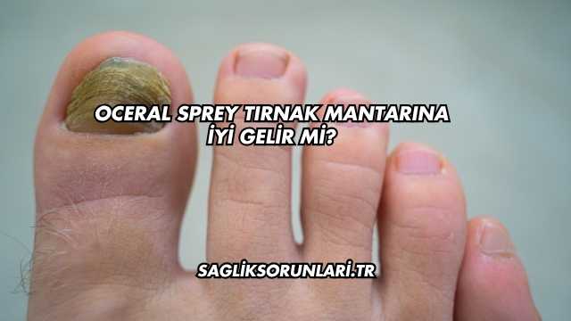 Oceral Sprey Tırnak Mantarına İyi Gelir mi?