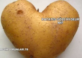 Patates Göze İyi Gelir mi?
