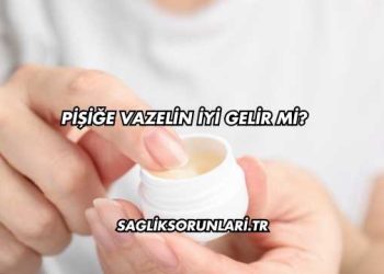 Pişiğe Vazelin İyi Gelir mi?