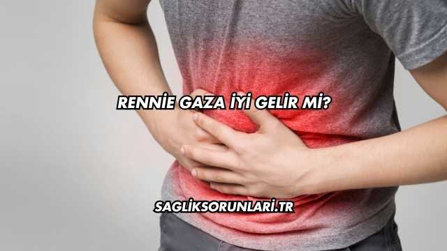 Rennie Gaza İyi Gelir mi?