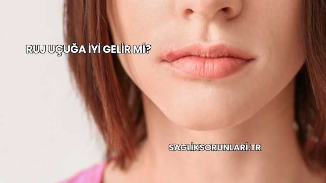 Ruj Uçuğa İyi Gelir mi?