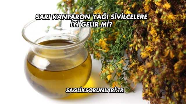 Sarı Kantaron Yağı Sivilcelere İyi Gelir mi