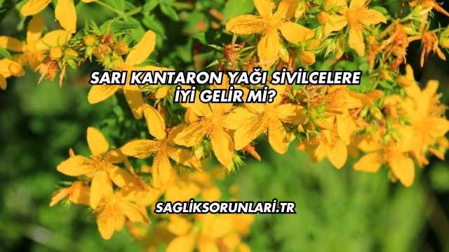 Sarı Kantaron Yağı Sivilcelere İyi Gelir mi