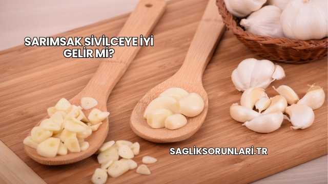 Sarımsak Sivilceye İyi Gelir mi?