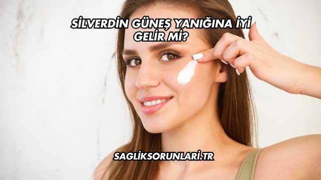 Silverdin Güneş Yanığına İyi Gelir mi?