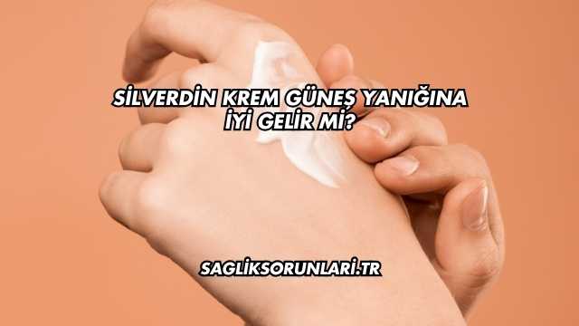 Silverdin Krem Güneş Yanığına İyi Gelir mi