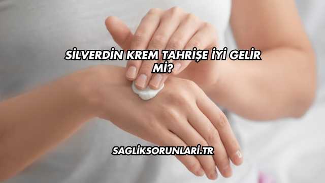 Silverdin Krem Tahrişe İyi Gelir mi?