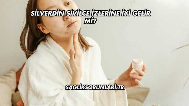 Silverdin Sivilce İzlerine İyi Gelir mi?