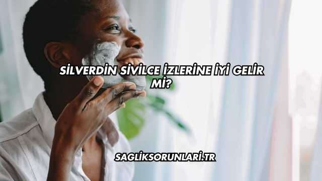 Silverdin Sivilce İzlerine İyi Gelir mi?