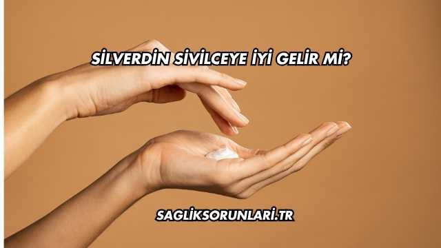 Silverdin Sivilceye İyi Gelir mi?