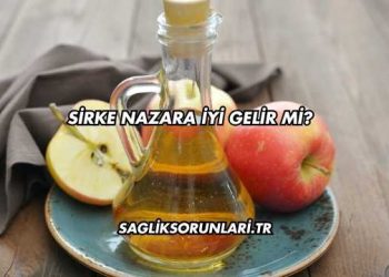 Sirke Nazara İyi Gelir mi?