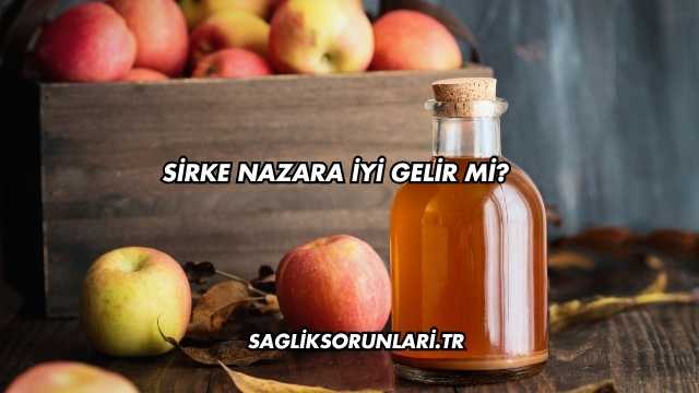 Sirke Nazara İyi Gelir mi?