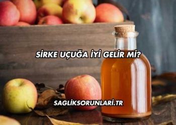 Sirke Uçuğa İyi Gelir mi?