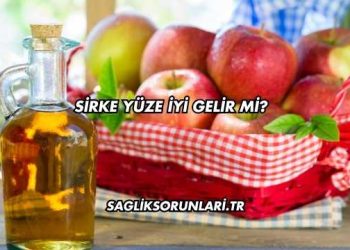 Sirke Yüze İyi Gelir mi?
