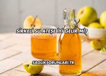 Sirkeli Su Ateşe İyi Gelir mi?