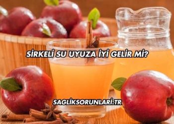Sirkeli Su Uyuza İyi Gelir mi?