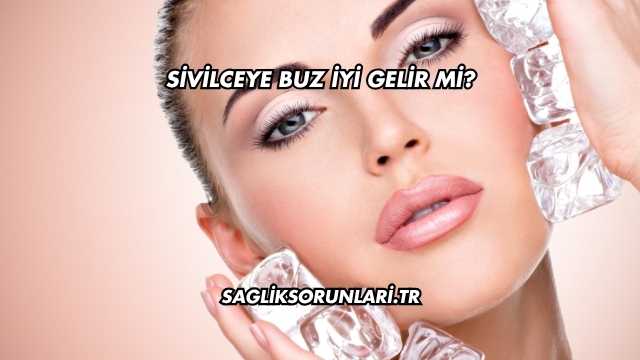Sivilceye Buz İyi Gelir mi?