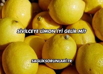 Sivilceye Limon İyi Gelir mi?