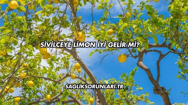 Sivilceye Limon İyi Gelir mi?