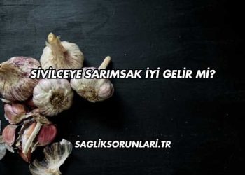 Sivilceye Sarımsak İyi Gelir mi?