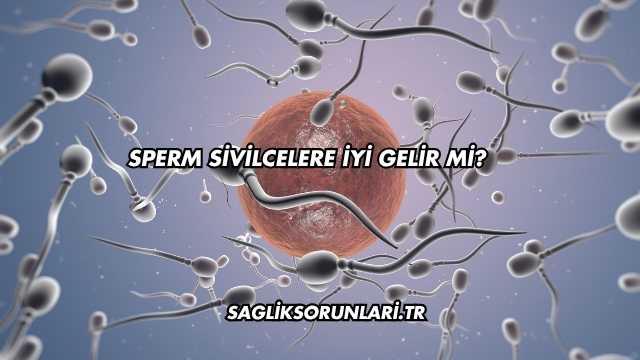 Sperm Sivilcelere İyi Gelir mi?