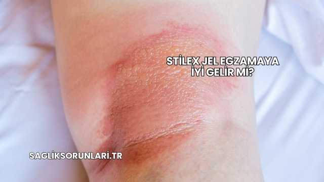 Stilex Jel Egzamaya İyi Gelir mi?