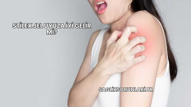 Stilex Jel Uyuza İyi Gelir mi?