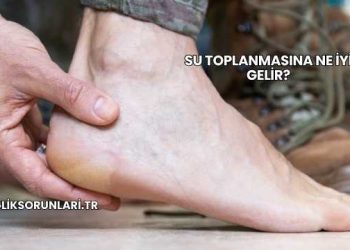 Su Toplanmasına Ne İyi Gelir?