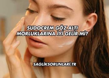 Sudocrem Göz Altı Morluklarına İyi Gelir mi?