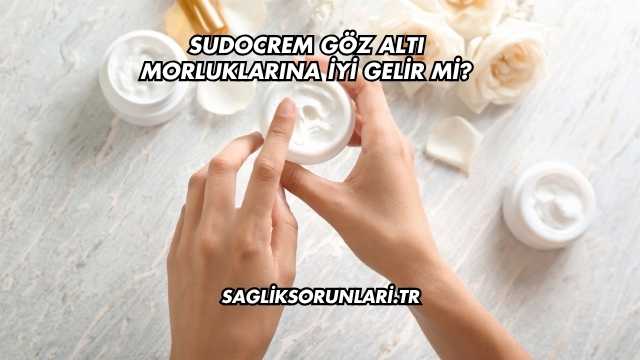 Sudocrem Göz Altı Morluklarına İyi Gelir mi?