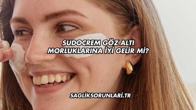 Sudocrem Göz Altı Morluklarına İyi Gelir mi?