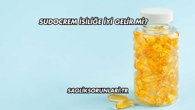 Sudocrem İsiliğe İyi Gelir mi?