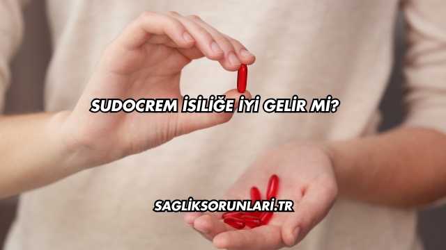 Sudocrem İsiliğe İyi Gelir mi?