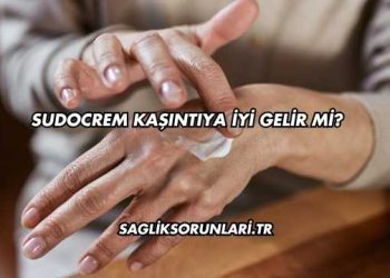 Sudocrem Kaşıntıya İyi Gelir mi?