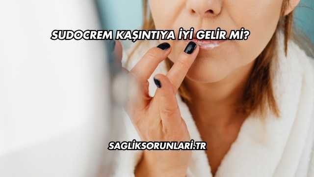 Sudocrem Kaşıntıya İyi Gelir mi?