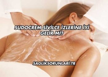 Sudocrem Sivilce İzlerine İyi Gelir mi?