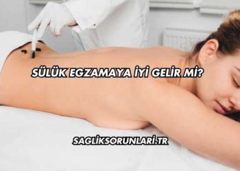 Sülük Egzamaya İyi Gelir mi?