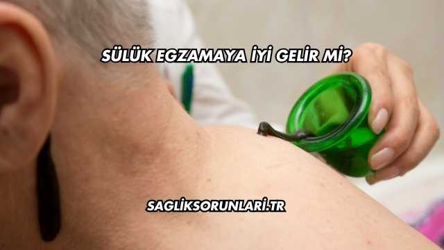 Sülük Egzamaya İyi Gelir mi?