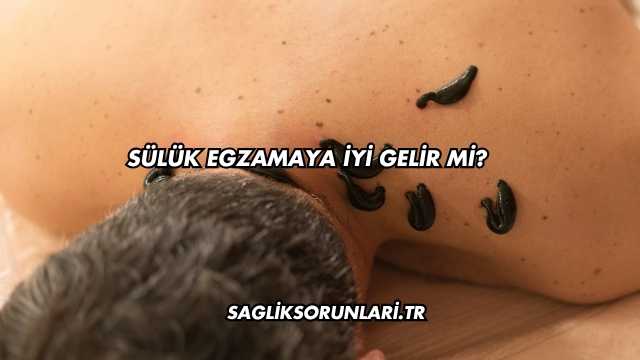 Sülük Egzamaya İyi Gelir mi?