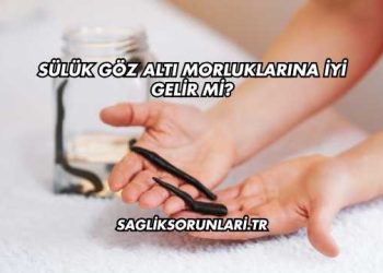 Sülük Göz Altı Morluklarına İyi Gelir mi?