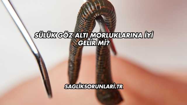 Sülük Göz Altı Morluklarına İyi Gelir mi?