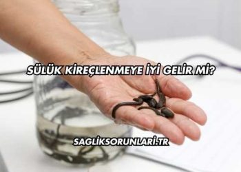 Sülük Kireçlenmeye İyi Gelir mi?