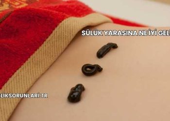 Sülük Yarasına Ne İyi Gelir?