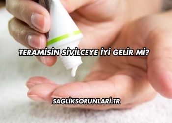 Teramisin Sivilceye İyi Gelir mi?