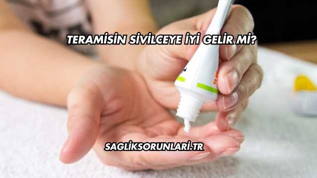 Teramisin Sivilceye İyi Gelir mi?