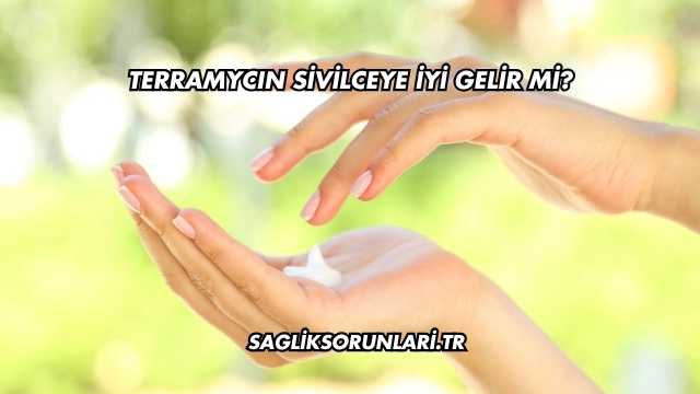 Terramycın Sivilceye İyi Gelir mi?